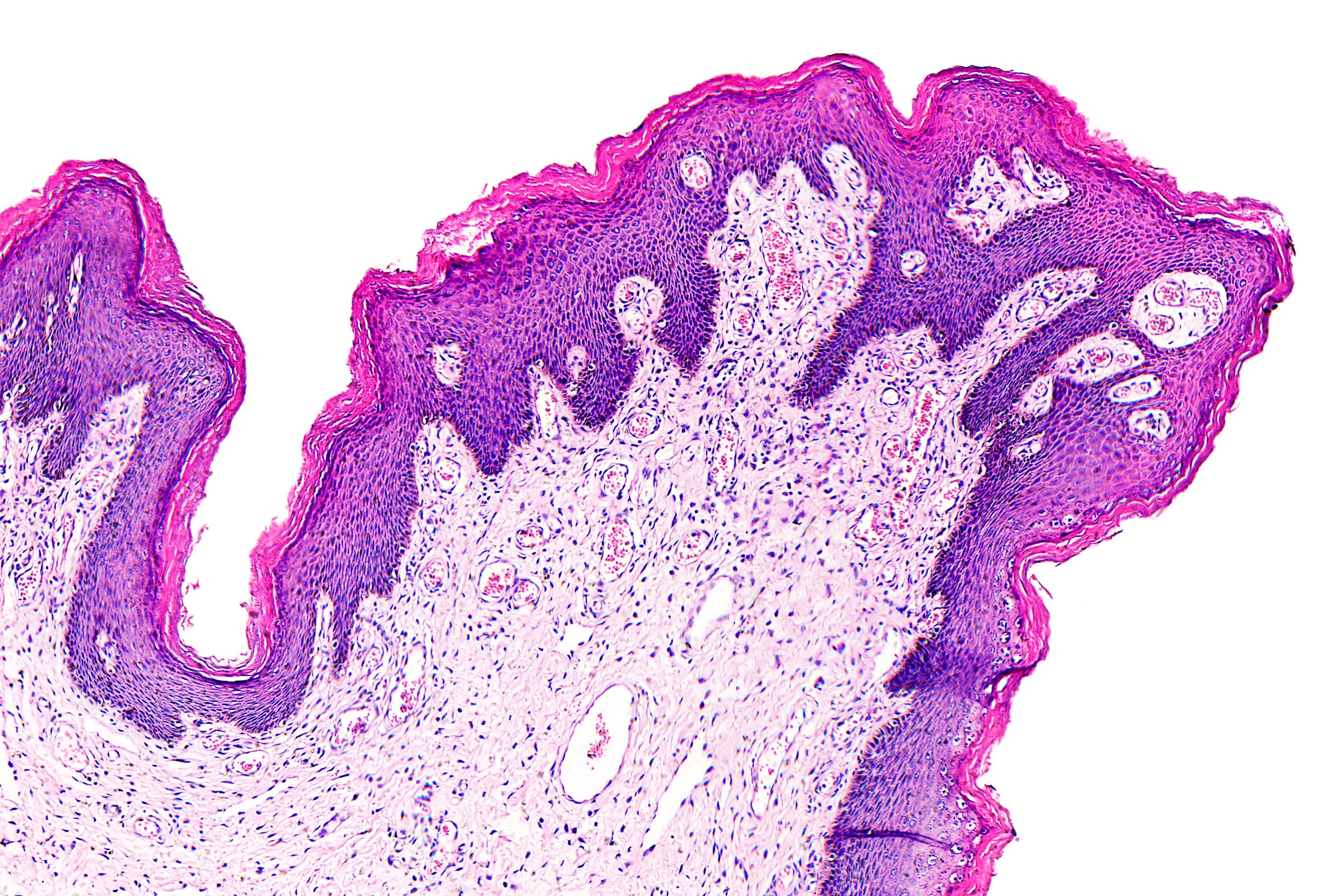 Pathology News Roundup: September 28, 2021